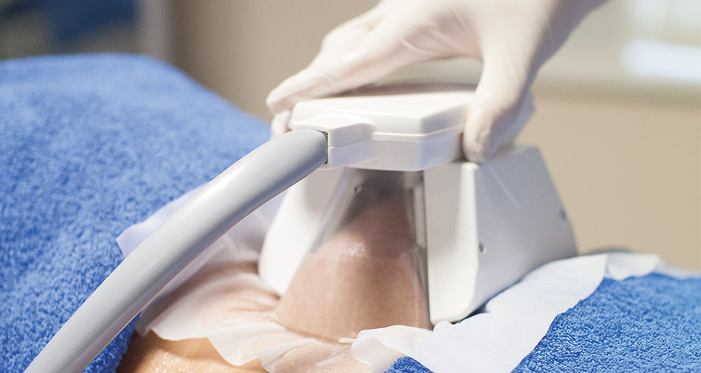 How Fat Freezing and HIFU Work Together? 2 Multiple Areas in One Session HIFU and Fat Freezing Hassocks